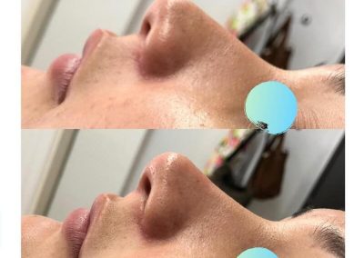 Dra Elisa Matheus Rinomodelacion (2)