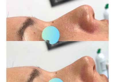 Dra Elisa Matheus Rinomodelacion (6)