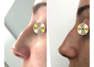 Dra Elisa Matheus Rinomodelacion (7)