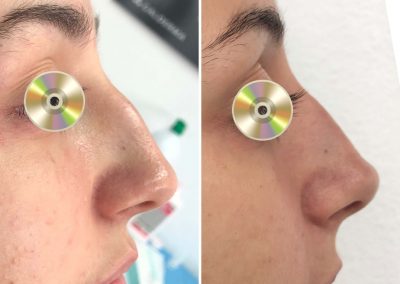 Dra Elisa Matheus Rinomodelacion (9)